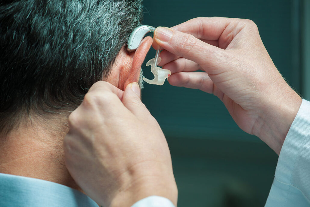 Hearing Loss may cause Dementia and Early Death? Exploring the Potential of AIDEVI NMN Supplements for Longevity