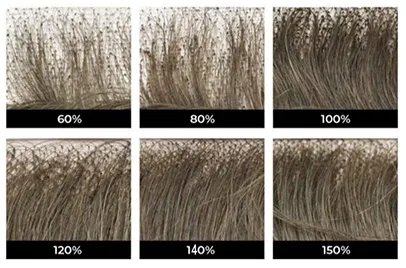 Men's hair density