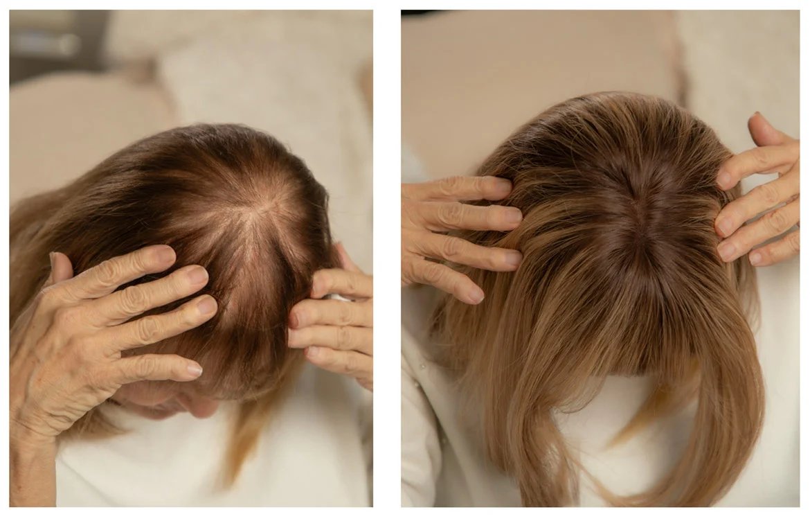 Goodyard human hair topper before and after