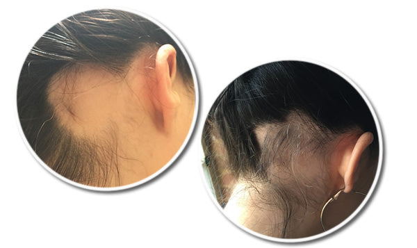 Michelle's Reseed Hair Care Story