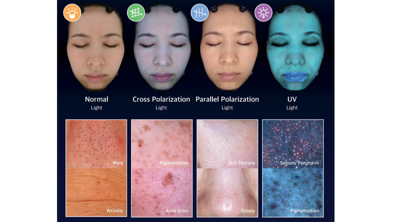 AI SKIN ANALYSER - PureMed