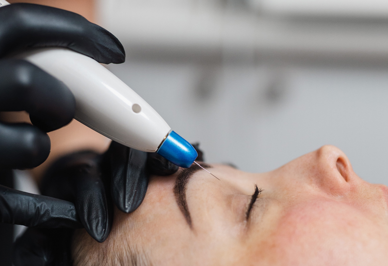 PLASMA SKIN TIGHTENING - Oi Cosmetic Studio