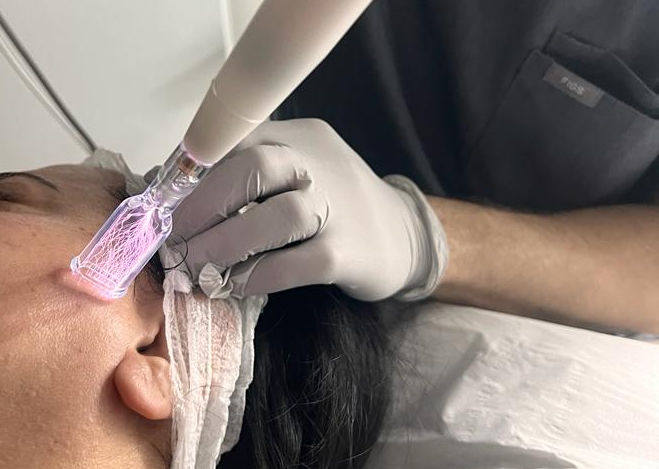 Cold Atmospheric Plasma (CAP) Treatment | Andy Millward