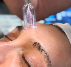 Cold Fusion | Luxury Laser Center