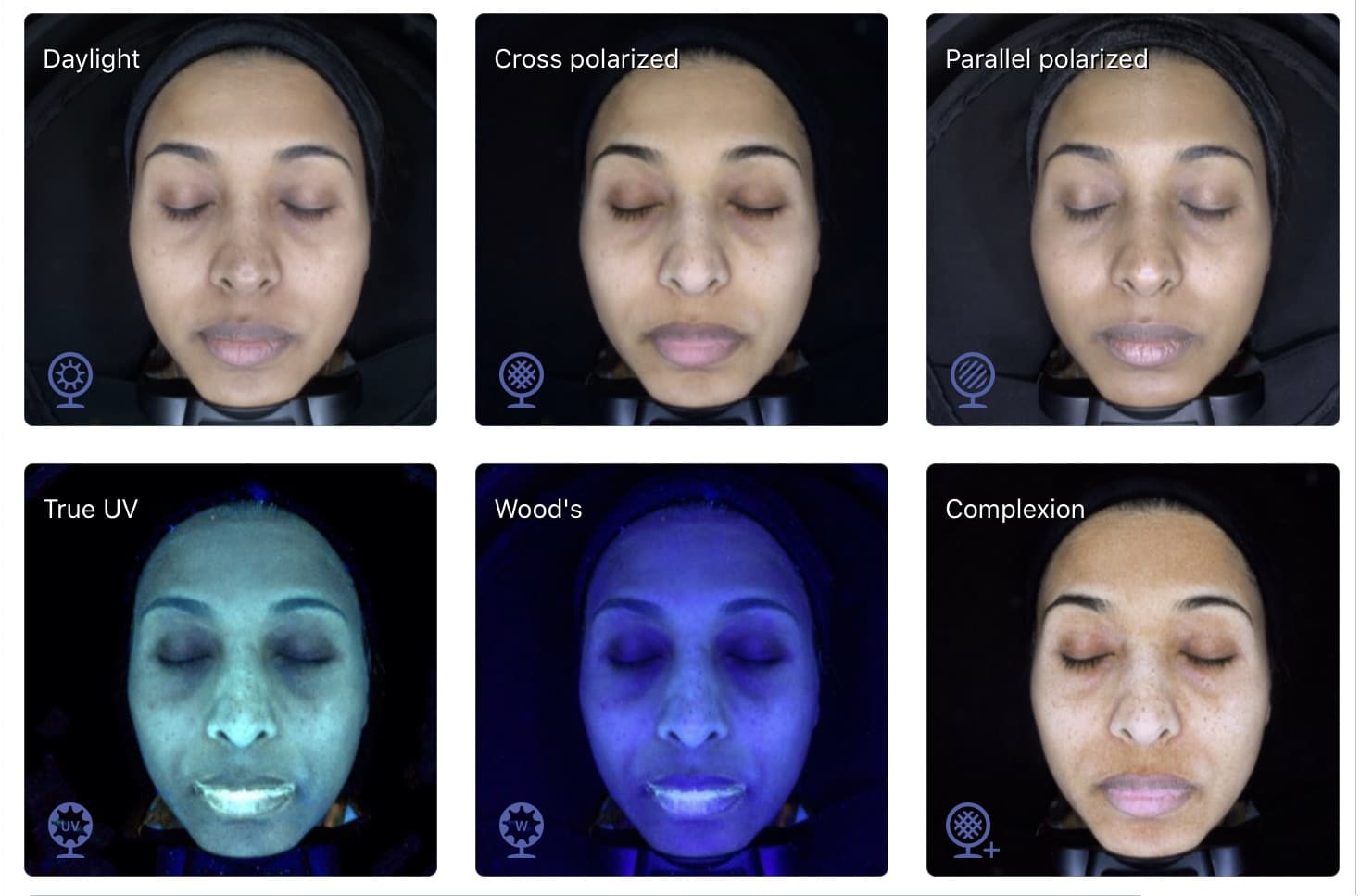 What would your Skin Analysis reveal? - Skin Enhance And Wellness