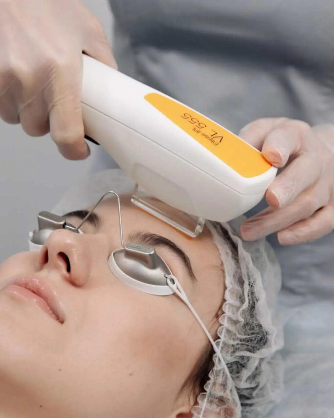 Nordlys – Laser, IPL, Fractional Resurfacing & YAG - Illuminate Skin Clinics
