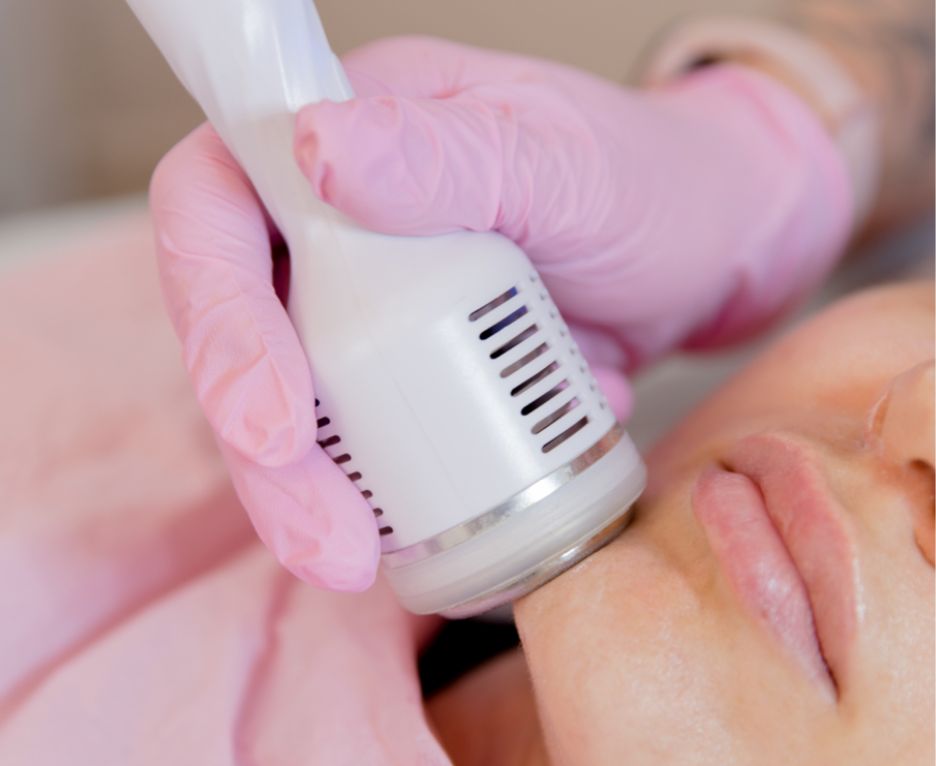 Transdermal Mesotherapy + Radiofrequency - The Skin Care Clinic