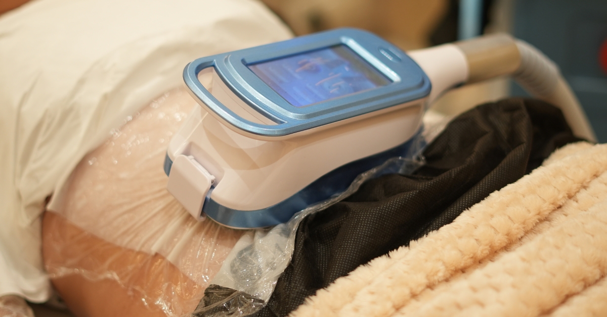 Customised Cryolipolysis Treatment Plan | VIVO Body Studio