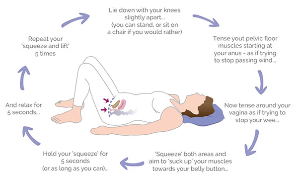 How To Do Kegel Exercises. &ldquo;Illustration showing step-by-step pelvic floor exercises, including lying down, tensing and lifting pelvic muscles, squeezing for five seconds and repeating