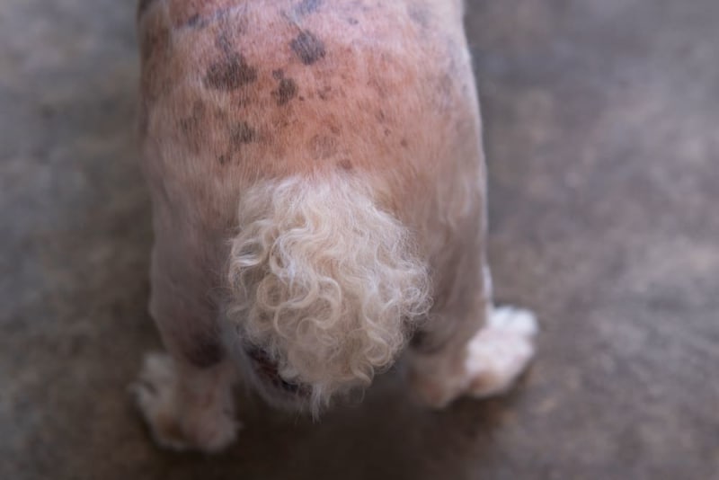 Fungal Infections