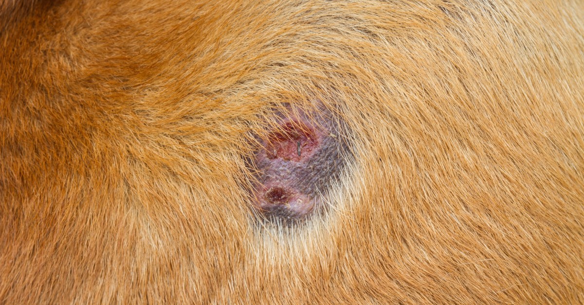 What is Bacterial Infection of the Skin?