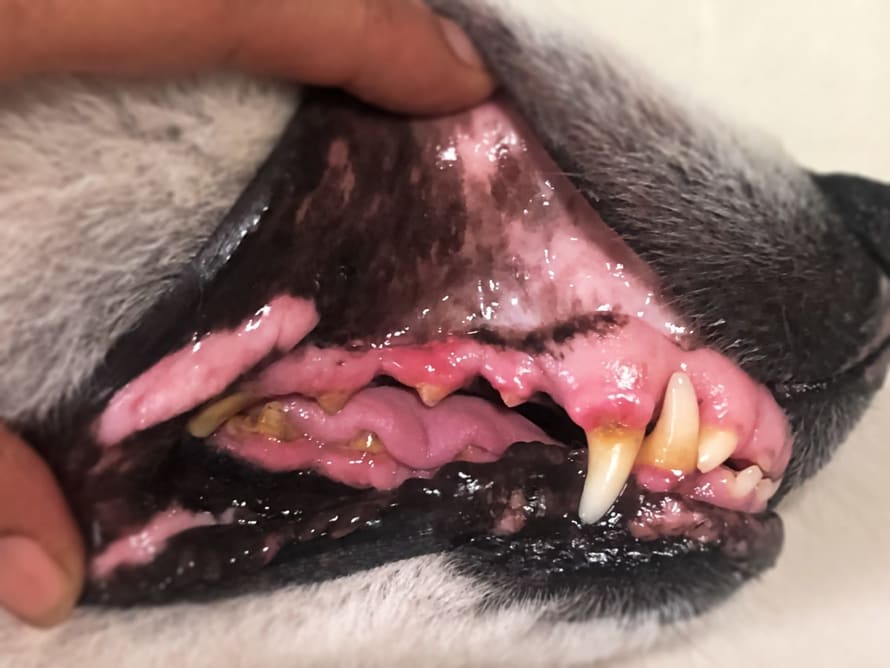 Periodontal Disease
