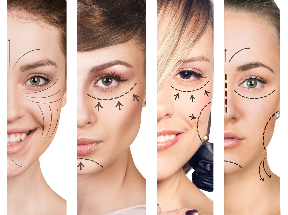 Surgical Facelift versus Non-Surgical Facelift - Leonard Miller, MD
